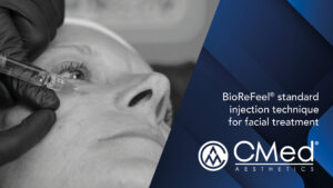 BioReFeel® standard injection technique for facial treatment