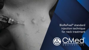 BioReFeel® standard injection technique for neck treatment
